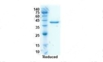 Recombinant SARS-CoV-2 RBD antibody