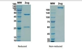 Recombinant SARS-CoV-2(S1)-6 antibody