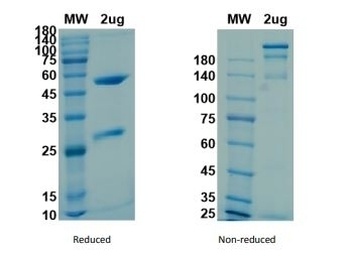 Recombinant SARS-CoV-2 (S1) -1 Neutralizing antibody Antibody