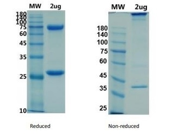 Recombinant CoV-2/COVID-19 Spike Glycoprotein Antibody
