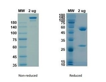 Recombinant SARS-CoV-2 (COVID-19) (S1) -4 Antibody [H4]