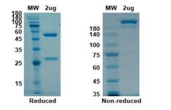 Recombinant SARS-CoV-2 (COVID-19) (S1) -3 Antibody [B38]