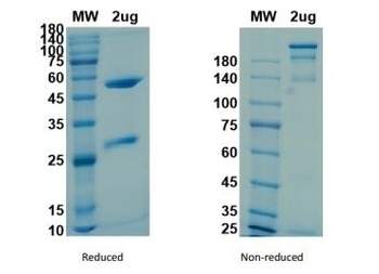 Recombinant SARS-CoV-2 (COVID-19) (S1) -1 Antibody [CR3022]