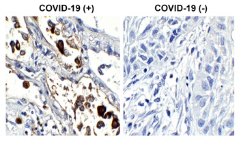 SARS-CoV-2 (COVID-19) Nucleocapsid Antibody [84D7]