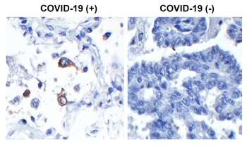 SARS-CoV-2 (COVID-19) Nucleocapsid Antibody [75G5a]