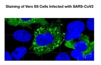 SARS-CoV-2 Nucleocapsid Antibody