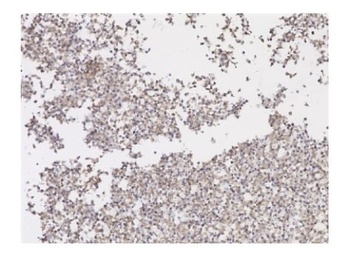 SARS-CoV-2 Spike RBD Antibody [2165] (HRP)