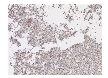 SARS-CoV-2 Spike RBD Antibody [2165] (Biotin)