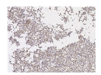 SARS-CoV-2 Spike RBD Antibody [2165]