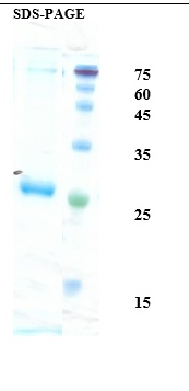 Interleukin 6 Recombinant Protein