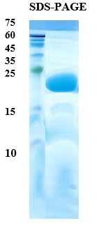 Interleukin 1 beta Recombinant Protein