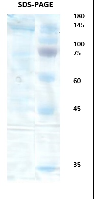 SARS-CoV-2 (Covid-19) whole spike trimer Recombinant Protein