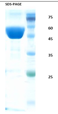 SARS-CoV-2 (Covid-19) nucleocapsid (N) (Omicron, B.1.1.529) Recombinant Protein