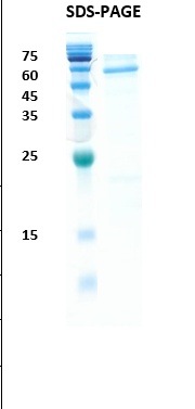 SARS-CoV-2 (Covid-19) nucleocapsid (N) (insect cell) Recombinant Protein