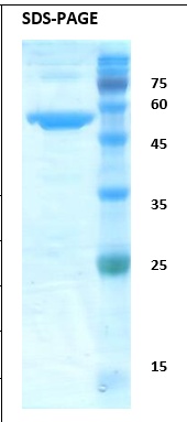 SARS-CoV-2 (Covid-19) nucleocapsid (N) Recombinant Protein