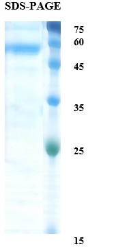 Zika virus NS1 protein Recombinant Protein