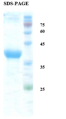 Rubella virus E1-E2 Recombinant Protein