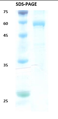 HIV-2 Envelope gp36 Recombinant Protein