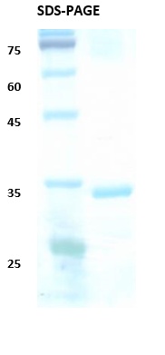 HIV-2 Envelope gp36 Recombinant Protein