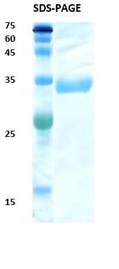 HIV-2 Envelope gp36 Recombinant Protein