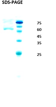 HIV-1 Type O Envelope gp120/gp41 Recombinant Protein