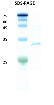HIV-1 Gag p24 Recombinant Protein