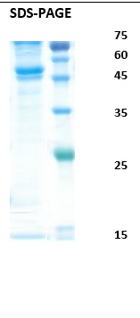 Dengue virus 4 envelope Recombinant Protein