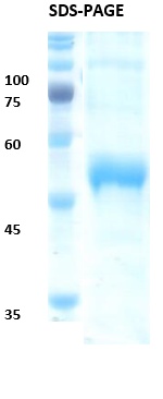 Dengue virus 3 NS1 Recombinant Protein