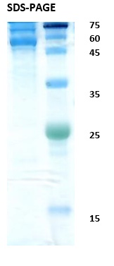 Dengue virus 1 envelope Recombinant Protein