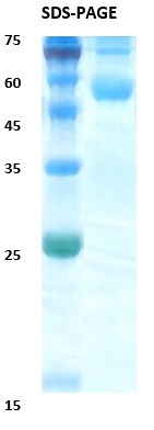 Chikungunya wild type envelope E1 Recombinant Protein