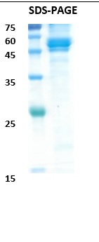 Chikungunya mutant envelope E1 Recombinant Protein