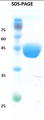 Chikungunya capsid Recombinant Protein