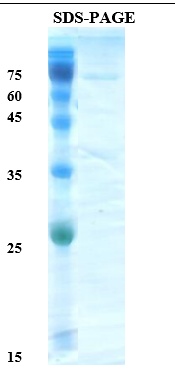 Helicobacter pylori (H. pylori) VacA Recombinant Protein