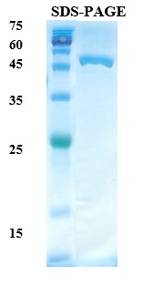 Helicobacter pylori (H. pylori) CagA Recombinant Protein