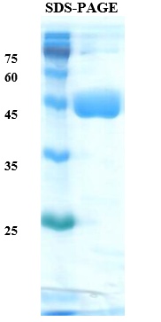Helicobacter pylori (H. pylori) CagA Recombinant Protein