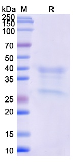 Monkeypox virus/MPXV H3L Recombinant Protein