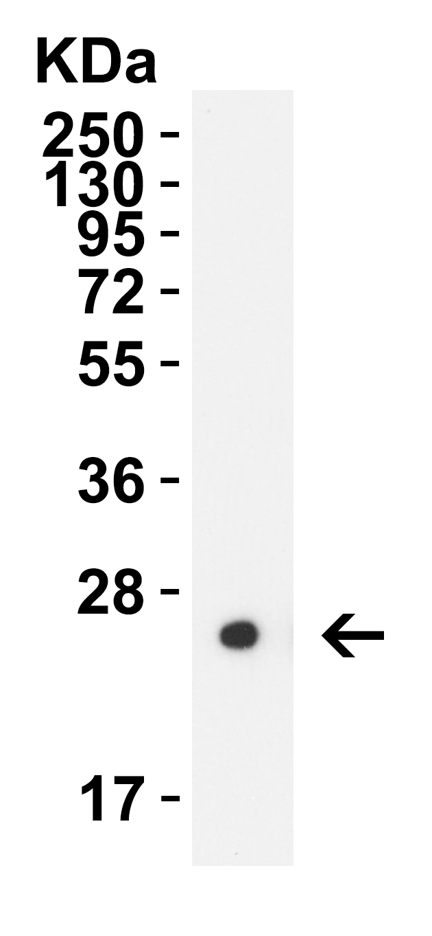 HIV-1 p24 Antibody [2F1A8]