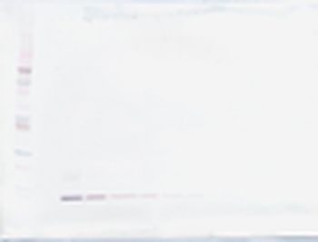 MIP-5 (CCL15) Antibody (biotin)