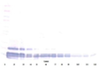 Eotaxin (CCL11) Antibody