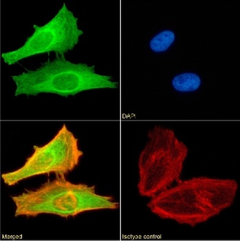 FOXP2 Antibody [RAB-S249], Rabbit IgG