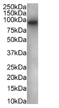 FOXP1 Antibody [RAB-S37], Rabbit IgG