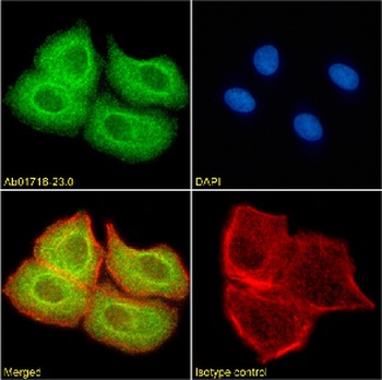 SUV420H2 Antibody [RAB-C409], Rabbit IgG