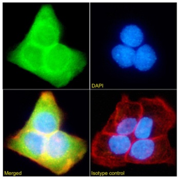 SFMBT1 Antibody [RAB-C396], Rabbit IgG