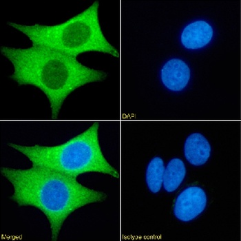PRMT3 Antibody [RAB-C372], Rabbit IgG