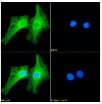 PRDM9 Antibody [RAB-C370], Rabbit IgG
