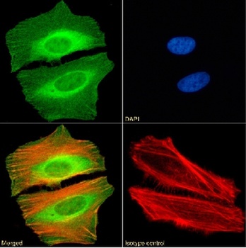 CBX2 Antibody [RAB-C238], Rabbit IgG