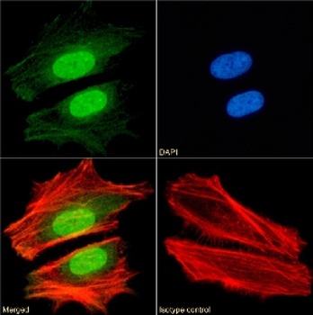 CBX1 Antibody [RAB-C145], Rabbit IgG