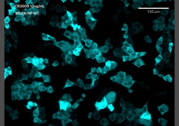 Covid-19 & SARS-CoV Nucleoprotein Antibody [CR3009 (03-009)], Human IgG1