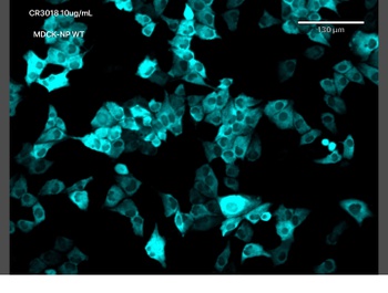 Covid-19 & SARS-CoV Nucleoprotein Antibody [CR3018 (03-018)], Human IgG1