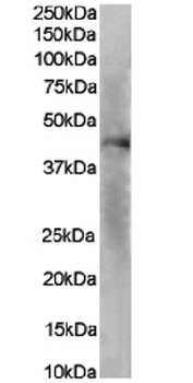 IL-8RA Antibody [SE2], Rabbit IgG